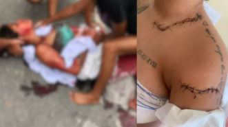 Cabo Frio: Homem acusado de atacar grávida é julgado dois anos após crime brutal